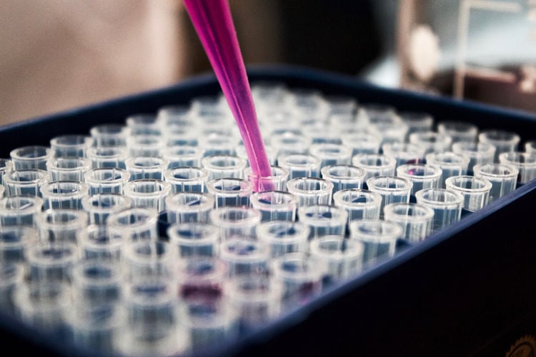 pipette and a set of small tubes in a science research lab; chemistry and biology research for determining medication interactions