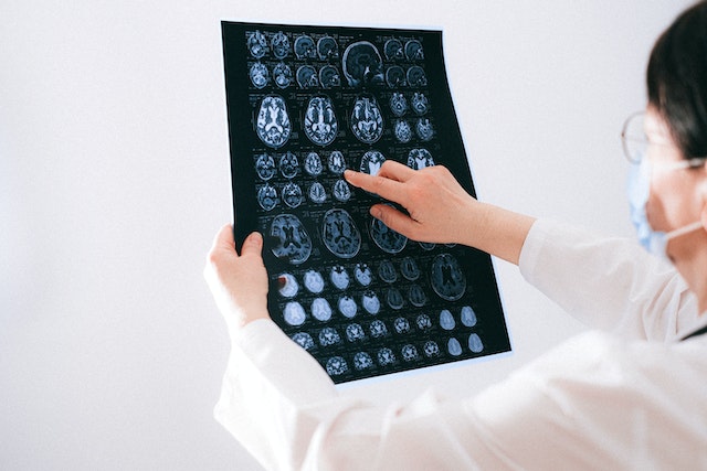 a neurologist looking at a brain scan image to determine if the patient has adhd or a brain injury or both