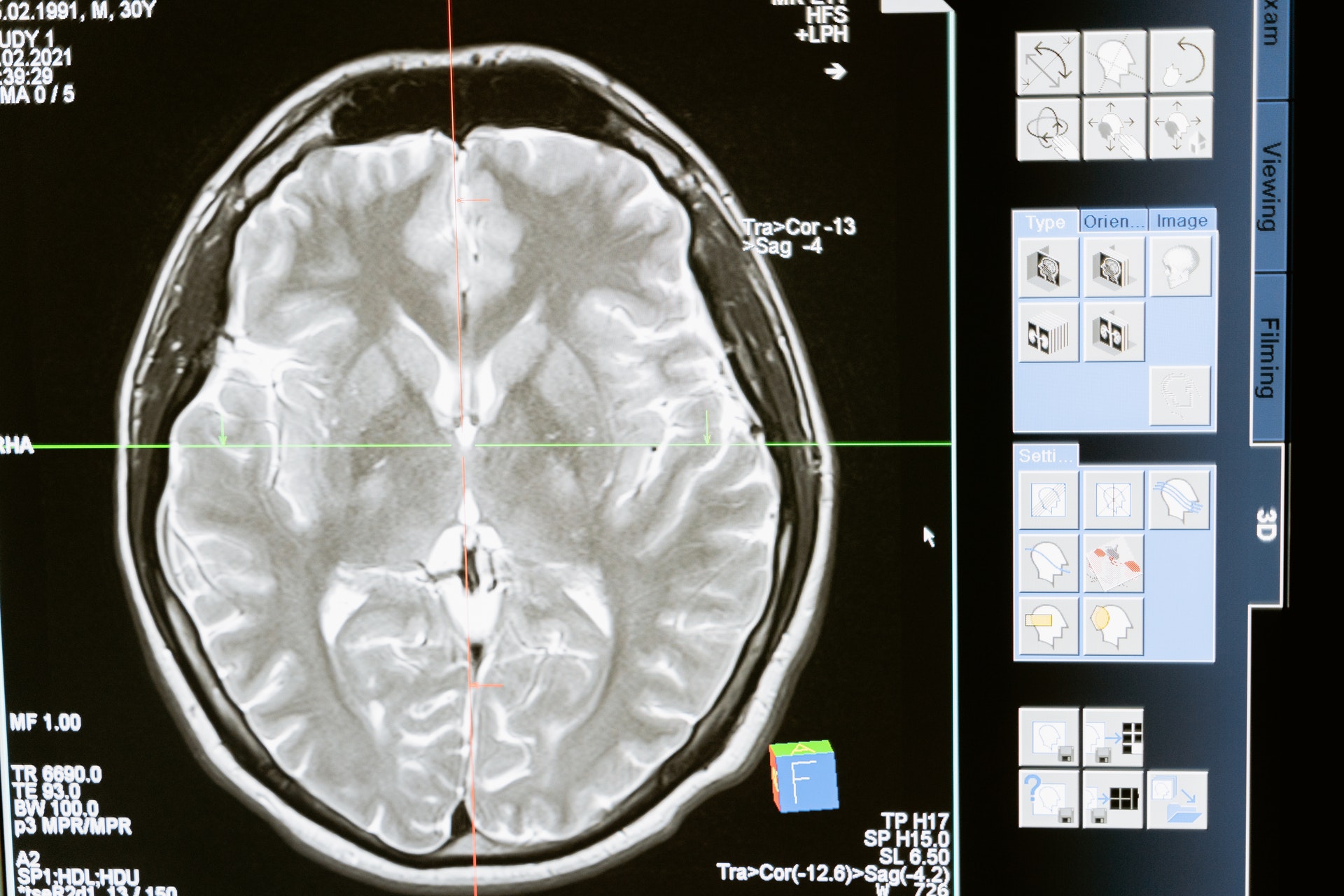 image of a brain scan
